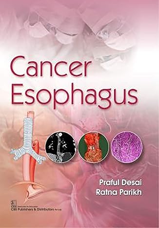 Cancer Esophagus (Pb 2020) 